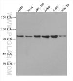 GNE Antibody in Western Blot (WB)