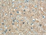 P2RY1 Antibody in Immunohistochemistry (Paraffin) (IHC (P))