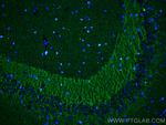 P2RY1 Antibody in Immunohistochemistry (PFA fixed) (IHC (PFA))