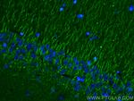 P2RY1 Antibody in Immunohistochemistry (PFA fixed) (IHC (PFA))