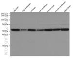 P2RY1 Antibody in Western Blot (WB)