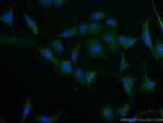 IMPDH2 Antibody in Immunocytochemistry (ICC/IF)