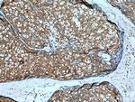 IMPDH2 Antibody in Immunohistochemistry (Paraffin) (IHC (P))