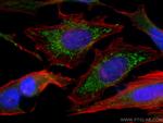 SNX5 Antibody in Immunocytochemistry (ICC/IF)