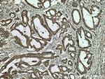 MTHFD1 Antibody in Immunohistochemistry (Paraffin) (IHC (P))