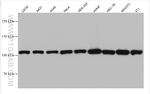 MTHFD1 Antibody in Western Blot (WB)