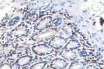 DVL1 Antibody in Immunohistochemistry (Paraffin) (IHC (P))