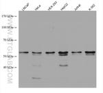 RNMT Antibody in Western Blot (WB)