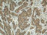 EIF2AK1 Antibody in Immunohistochemistry (Paraffin) (IHC (P))