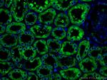 ERP29 Antibody in Immunohistochemistry (Paraffin) (IHC (P))