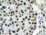 NF45 Antibody in Immunohistochemistry (Paraffin) (IHC (P))