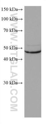 ASL Antibody in Western Blot (WB)