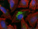 SNF8 Antibody in Immunocytochemistry (ICC/IF)