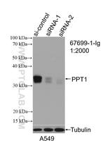 PPT1 Antibody in Western Blot (WB)