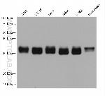 PPT1 Antibody in Western Blot (WB)