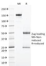 StAR (Steroidogenic Acute Regulator) (Leydig Cell Marker) Antibody in SDS-PAGE (SDS-PAGE)