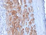 StAR (Steroidogenic Acute Regulator) Antibody in Immunohistochemistry (Paraffin) (IHC (P))