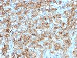 StAR (Steroidogenic Acute Regulator) Antibody in Immunohistochemistry (Paraffin) (IHC (P))