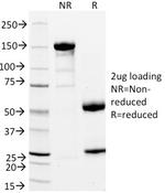 StAR (Steroidogenic Acute Regulator) Antibody in SDS-PAGE (SDS-PAGE)