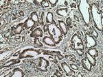 HNRNPK Antibody in Immunohistochemistry (Paraffin) (IHC (P))