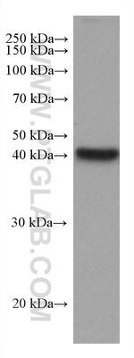 ADH6 Antibody in Western Blot (WB)