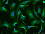 EPRS Antibody in Immunocytochemistry (ICC/IF)