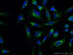 EPRS Antibody in Immunocytochemistry (ICC/IF)