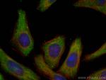 EIF3A Antibody in Immunocytochemistry (ICC/IF)