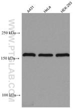 EIF3A Antibody in Western Blot (WB)