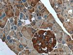 EIF3L Antibody in Immunohistochemistry (Paraffin) (IHC (P))