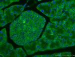 EIF3L Antibody in Immunohistochemistry (Paraffin) (IHC (P))