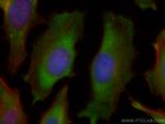 TXNRD1 Antibody in Immunocytochemistry (ICC/IF)