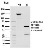 STAT2 Antibody in SDS-PAGE (SDS-PAGE)