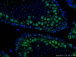 METTL3 Antibody in Immunohistochemistry (Paraffin) (IHC (P))