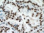 METTL3 Antibody in Immunohistochemistry (Paraffin) (IHC (P))