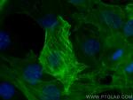 smooth muscle actin Antibody in Immunocytochemistry (ICC/IF)