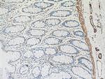 smooth muscle actin Antibody in Immunohistochemistry (Paraffin) (IHC (P))