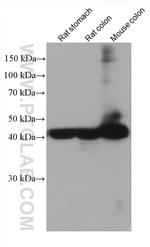 smooth muscle actin Antibody in Western Blot (WB)