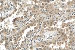 PTGES3 Antibody in Immunohistochemistry (Paraffin) (IHC (P))