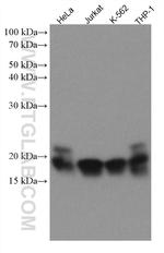 TNFAIP8 Antibody in Western Blot (WB)