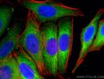 MARS Antibody in Immunocytochemistry (ICC/IF)