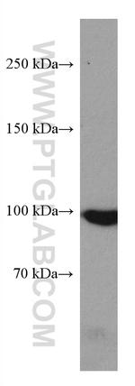 MARS Antibody in Western Blot (WB)