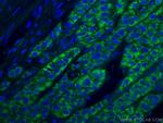 ACADM Antibody in Immunohistochemistry (Paraffin) (IHC (P))