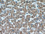 ACADM Antibody in Immunohistochemistry (Paraffin) (IHC (P))