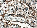 PTPN14 Antibody in Immunohistochemistry (Paraffin) (IHC (P))