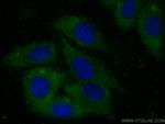 USP14 Antibody in Immunocytochemistry (ICC/IF)