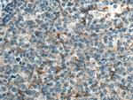 CD70 Antibody in Immunohistochemistry (Paraffin) (IHC (P))