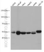 PRKAR2A Antibody in Western Blot (WB)