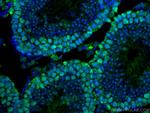 EED Antibody in Immunohistochemistry (Paraffin) (IHC (P))