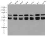 EED Antibody in Western Blot (WB)